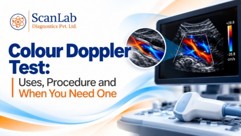 Colour Doppler Test: Uses, Procedure and When You Need One